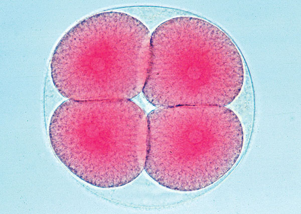 MP: Entwicklung des Seeigels (Psammechinus miliaris)