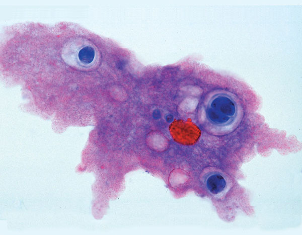 MP: Einzeller (Protozoa)