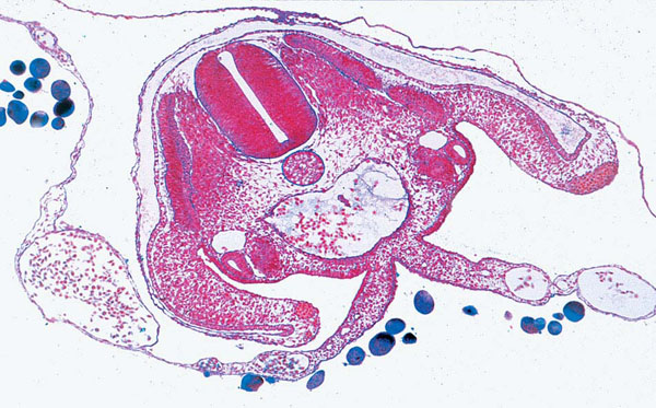 MP: Entwicklung des Huhnembryos (Gallus domesticus)