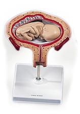 MOD: Uterus mit Fetus, 4.-5. Monat