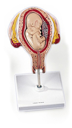 MOD: Uterus mit Fetus, Steißlage, 5. Monat, 2 tlg.