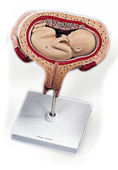 MOD: Uterus mit Fetus in Rückenlage, 5. Monat, 2-tlg.