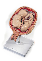 MOD: Uterus mit herausnehmbaren Feten (Zwillinge), 5. Monat, normale Position