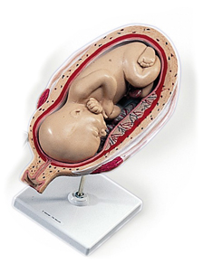 MOD: Fetus, 7. Monat