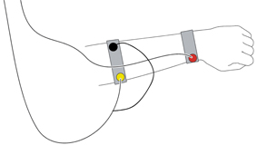 Elektromyogramm (EMG)